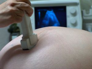 ecografii-gravide-screening